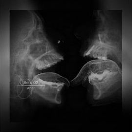 Anar - Bero 02 - Ultra Slowed Ft Polaris загрузить