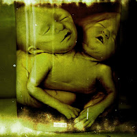 Bertiebanz - Empty Bones загрузить