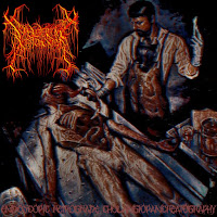 Diabetic Ketoacidosis - Endoscopicretrogradecholangiopancreatography загрузить