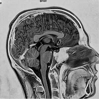 Otoy - Безумства загрузить